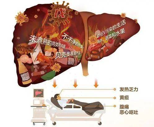 一文读懂“戊肝”